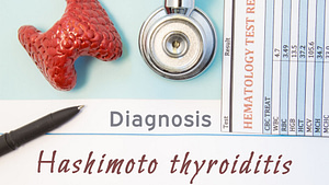 Choroba Hashimoto - objawy - leczenie