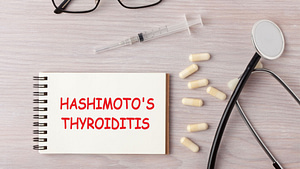 Hashimoto-niedoczynność tarczycy -leczenie-objawy-endokrynolog-warszawa